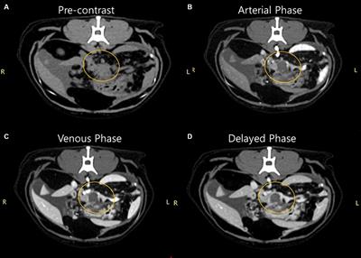 Case report: Sclerosing encapsulating peritonitis in a cat with disseminated pancreatic adenocarcinoma of presumed ductal origin